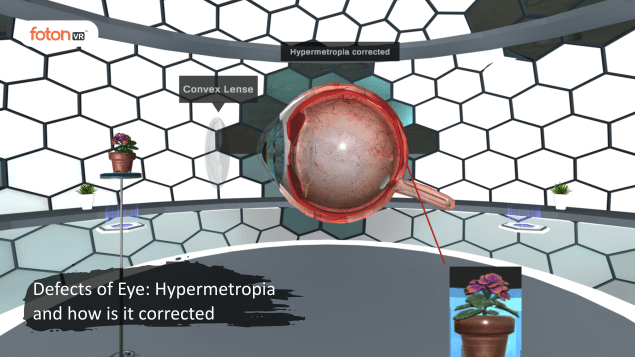 Virtual tour 6 Defects of Eye Hypermetropia and how is it corrected